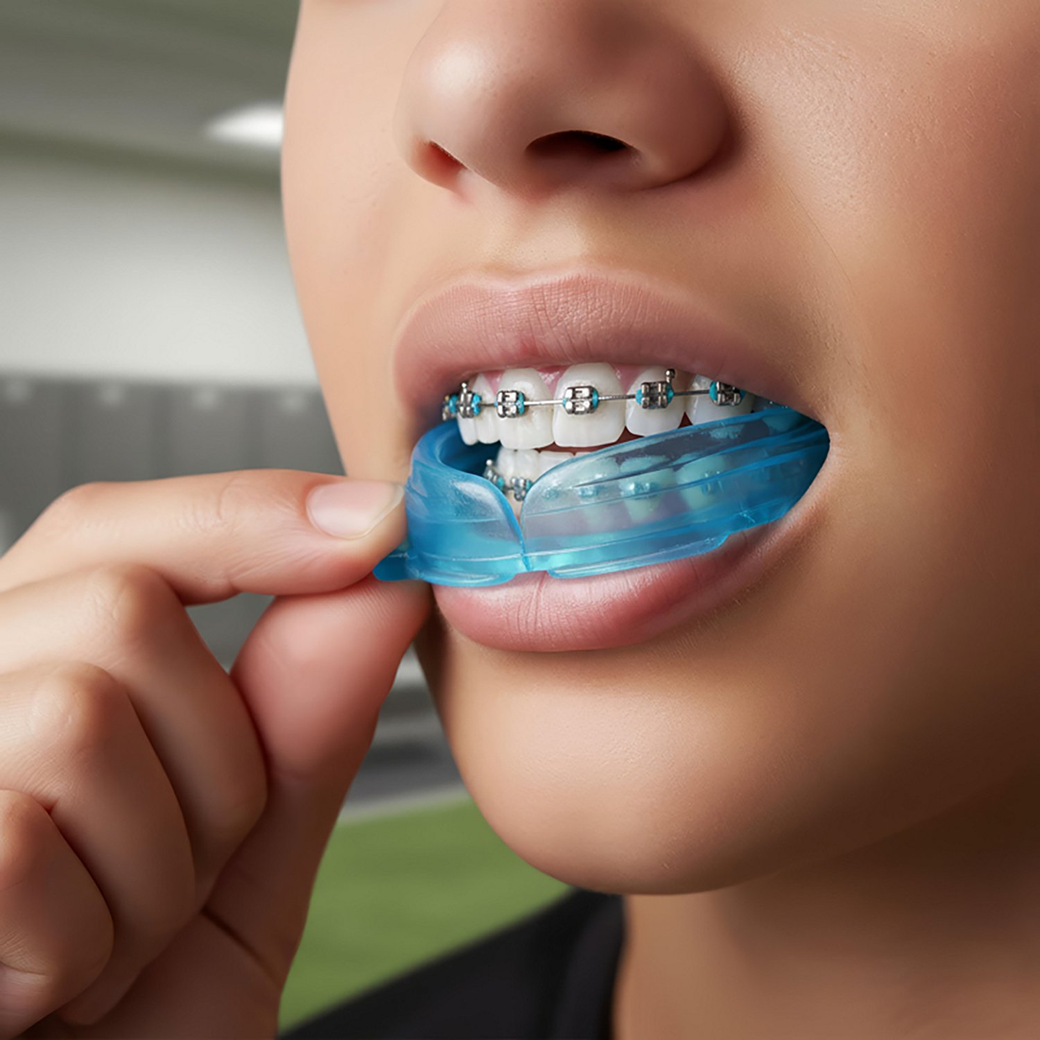 Shock Doctor Youth Braces Mouth Guard - view number 2